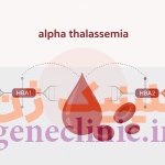 تالاسمی بتا (Beta Thalassemia) تالاسمی بتا (Beta Thalassemia) چیست؟