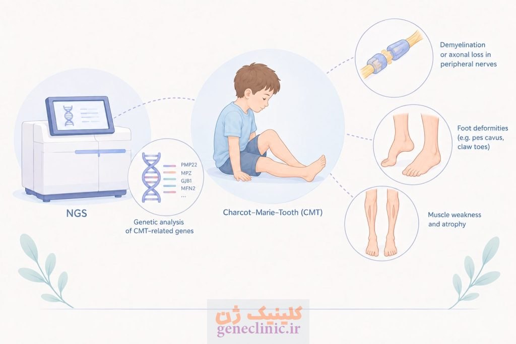 پنل NGS بیماری شارکو–ماری–توث (Charcot–Marie–Tooth NGS Panel)
