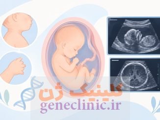سندرم اسمیت–لملی–اوپیتز (Smith-Lemli-Opitz syndrome) چیست؟