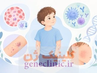 سندرم ویسکوت–آلدریچ (Wiskott–Aldrich Syndrome; WAS) چیست؟